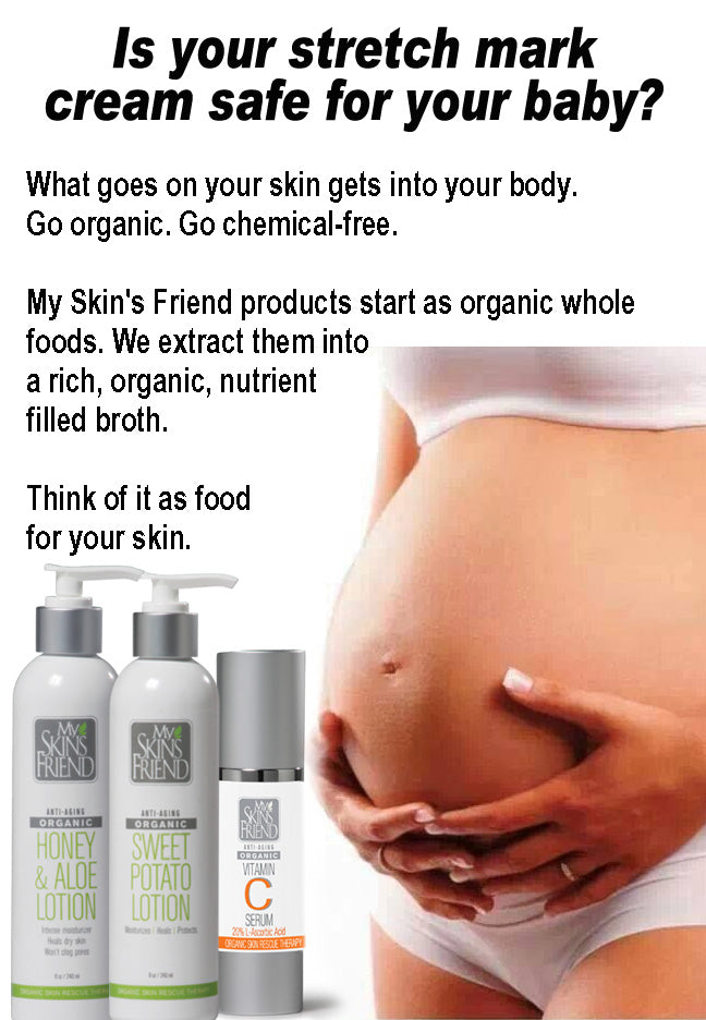 Weight Loss, Pregnancy, S-T-R-E-T-C-H Marks and Sweet Potatoes